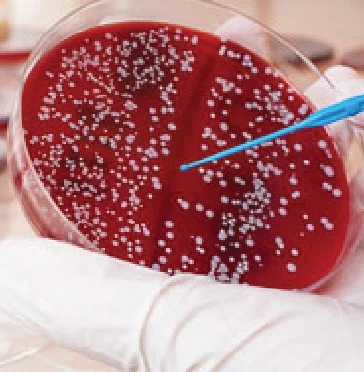 10 Unknown warning signs and symptoms of Blood Cancer